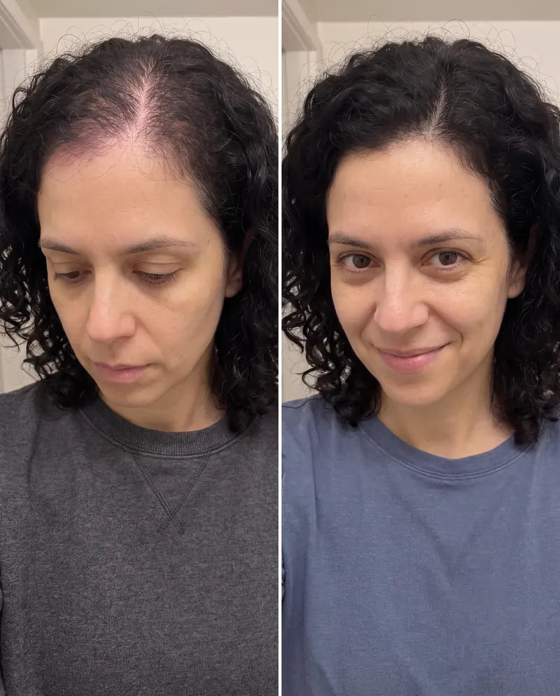 Visuel fourni : deux vues côte à côte d’une femme aux cheveux foncés et de sa ligne frontale.